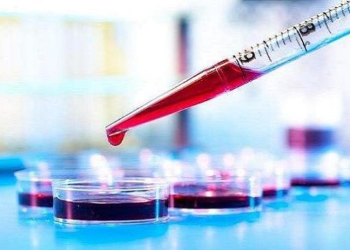 آزمایش خون می‌تواند بیماری کرون را پیش‌بینی کند