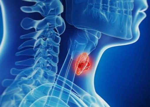 افزایش آمار تشخیص بدخیمی‌های تیروئیدی