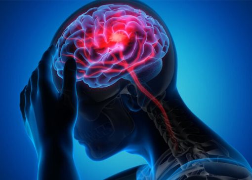 آیا مادر بودن از سکته مغزی پیشگیری می‌کند